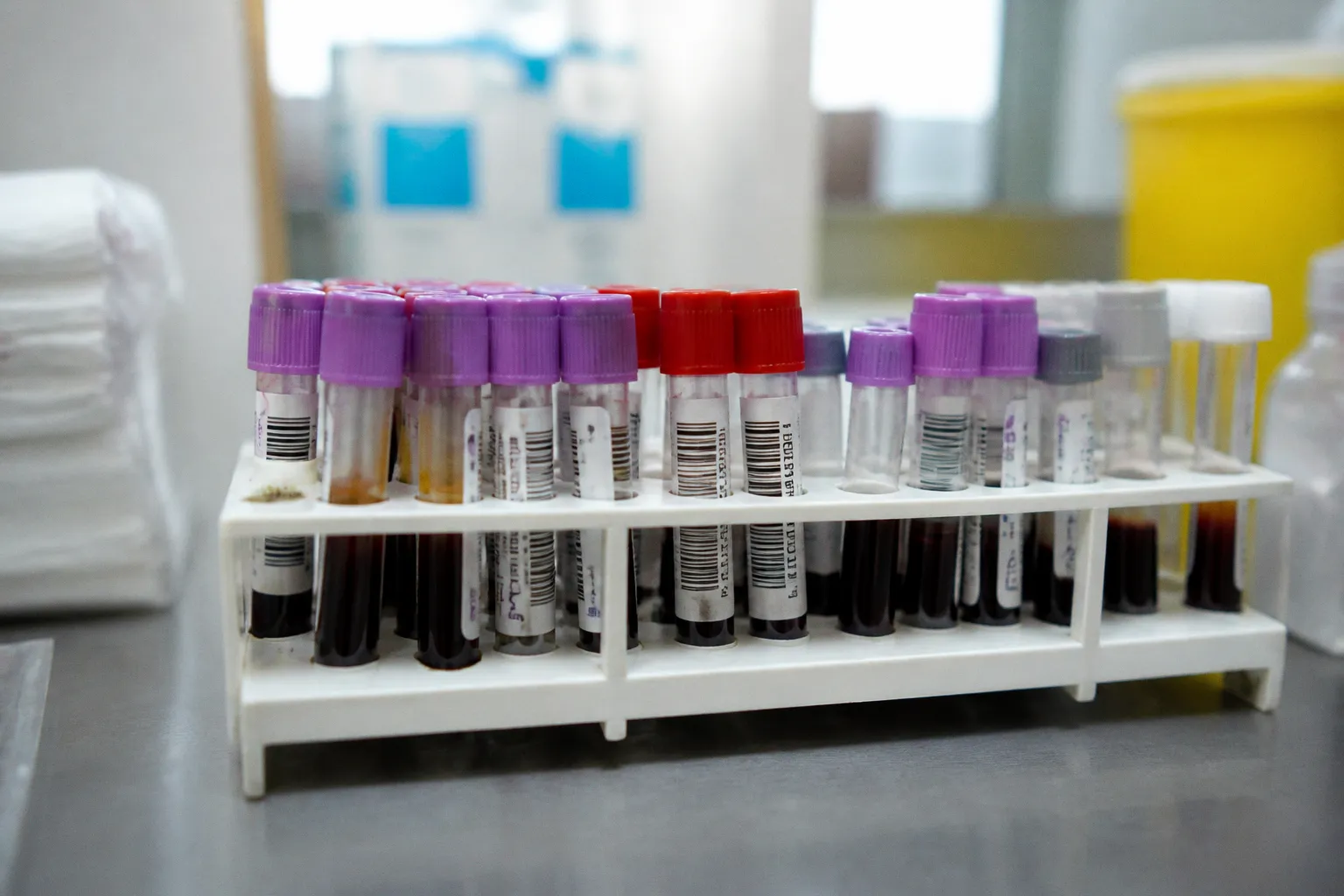 Santé mentale des ados : le dépistage par biomarqueurs sanguins